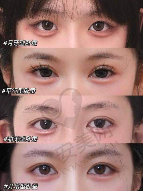 修复卧蚕后的感受如何？