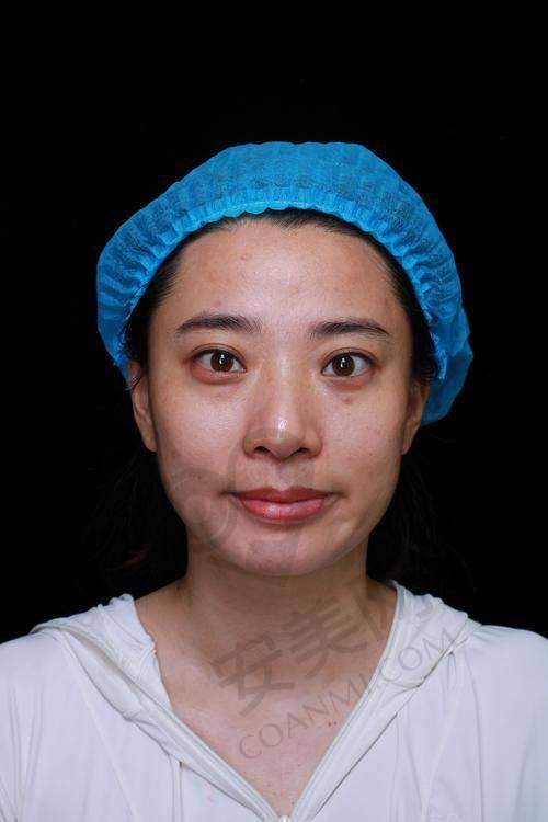 广州健丽去眼袋医院的口碑评价如何？
