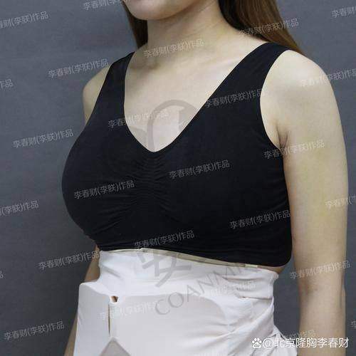 在湛江韩美胸部整形的总体感受如何？