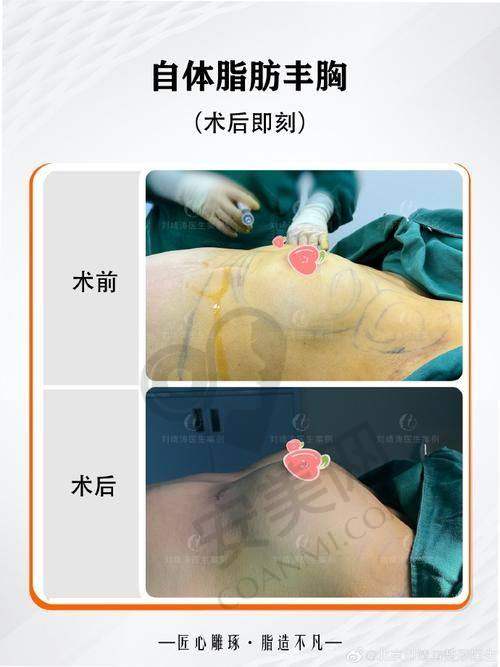 就诊过程是怎样的？