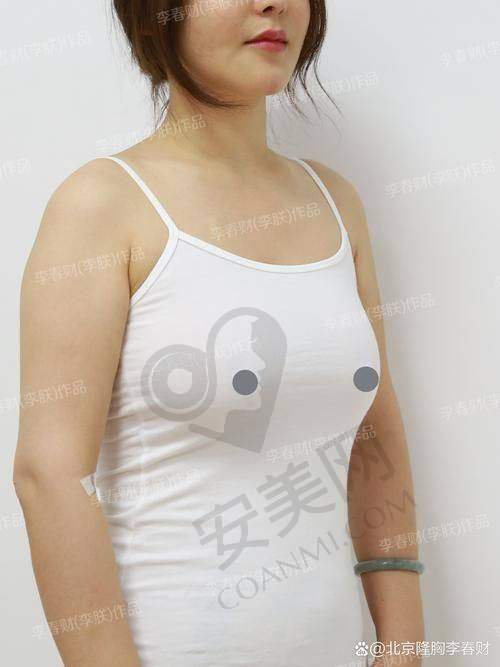 湛江韩美胸部整形医生技术如何？
