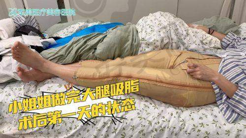 邓晟华院长在大腿吸脂领域有何独特之处？