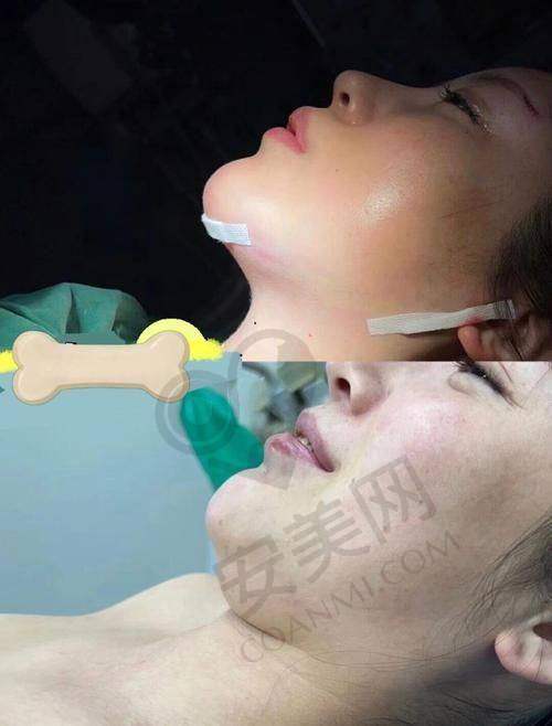 总结