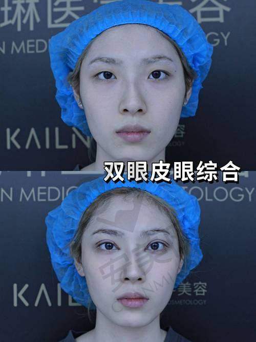 宜宾莱奥刁文静医生预约挂号指南