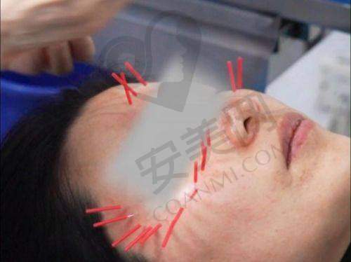 有哪些成功实例可以参考？
