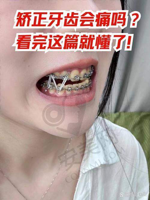 如何获取玉林蓝天口腔医院矫正牙齿的专属报价？