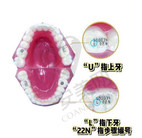 隐适美隐形矫正的过程是怎样的？