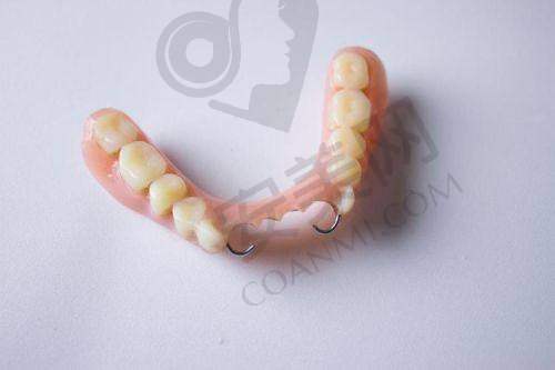 活动假牙的制作过程是怎样的？