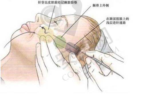 术后修复需要注意什么？
