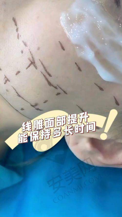 西安米兰柏羽医院的优势在哪里？