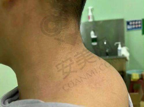 技术实力：专有技术与微创优势