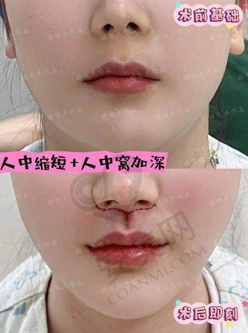 朱蕾 | 中山大学附属第三医院 - 整形美容科