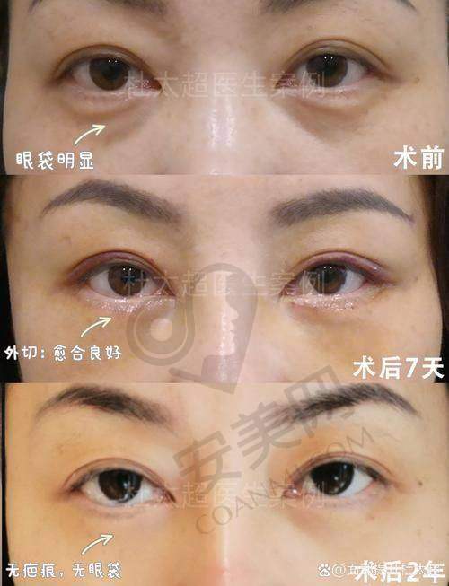患者对王杨医生的评价如何？
