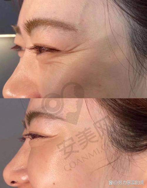 治疗后的成效和修复情况如何？