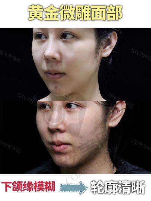 术后护理：确保手术成效的关键