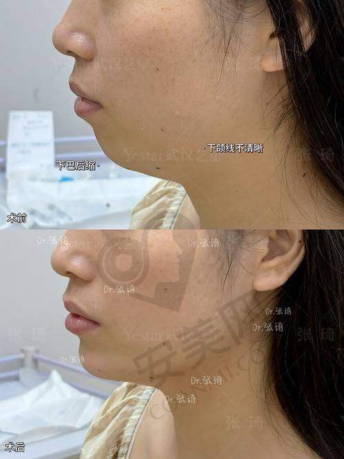 常见疑问解答