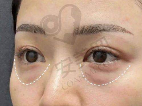 广州健丽去眼袋医院的环境设施如何？