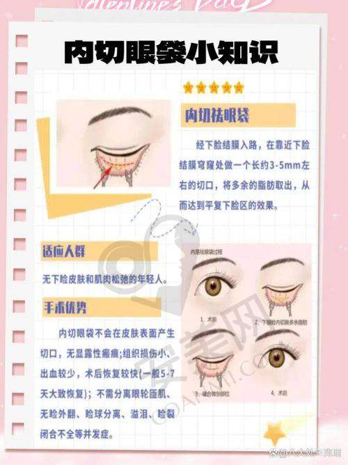 眼袋带来的困扰与内心的纠结
