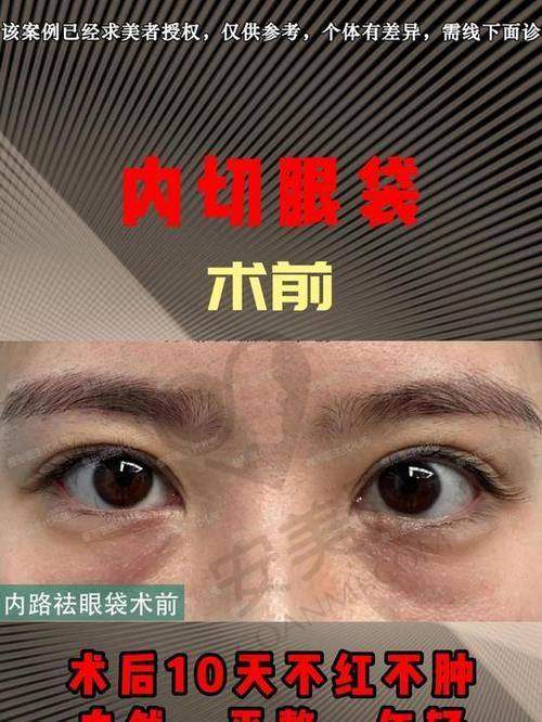 真实患者经验分享（避坑指南）