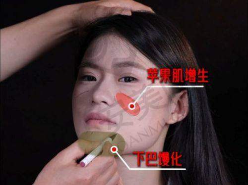 广州中家医家庭整形医院的口碑评价好不好？