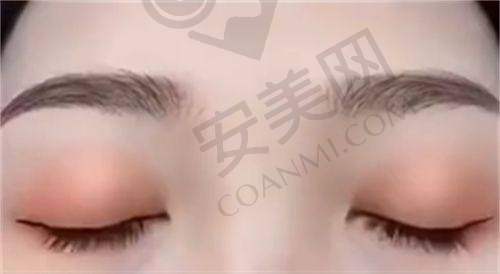 诊疗成效如何？