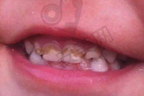 北京爵冠口腔门诊部服务质量如何？