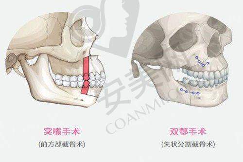 6、西安画美张沙沙医生预约挂号指南