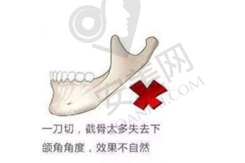 郑州圣熙格兰医疗整形的行业口碑能说明其不是渠道医院吗？