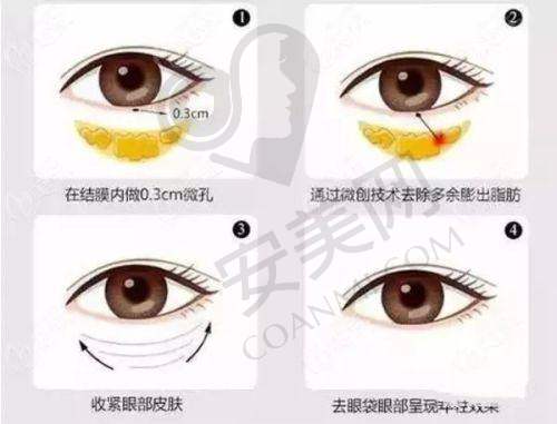 如何选择适合自己的整形医院？