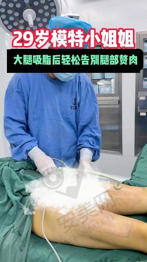 大腿吸脂价格分阶解析