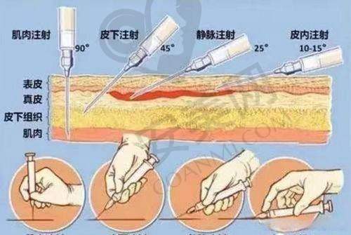 陈媛医生：注射界的美学大师？