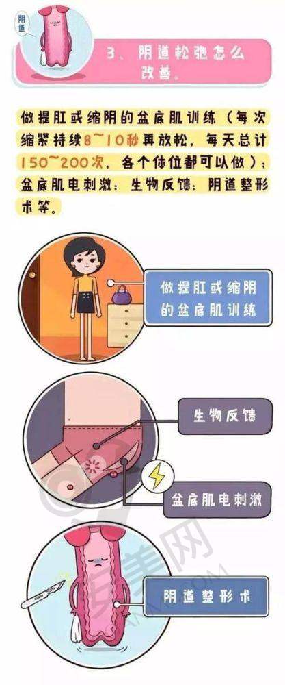 什么是阴道紧缩术，王艺洁医生为何值得信赖？
