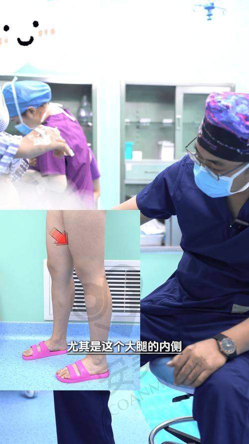 大腿吸脂手术过程是怎样的？