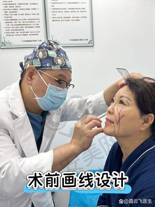 独特的拉皮技术：内窥镜下的精细操作