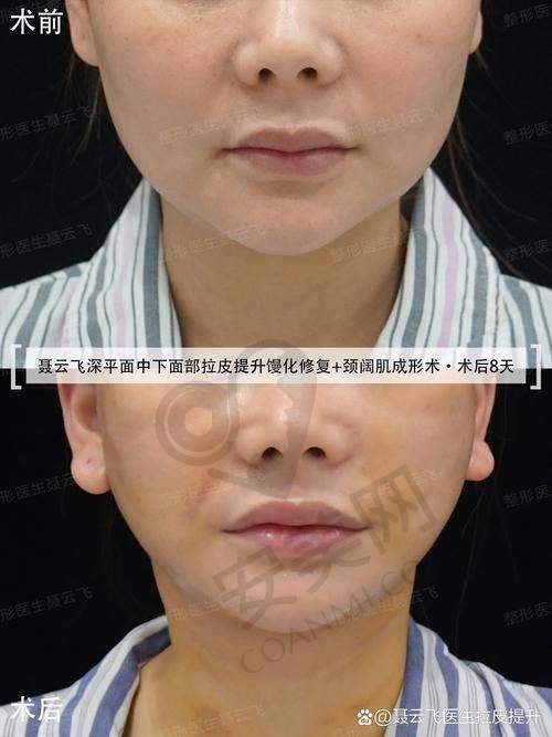 选择付国友医生的理由：专精与职责并重