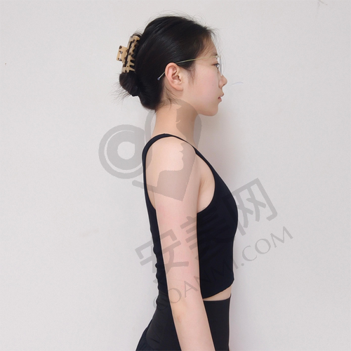 深圳美莱郭杰假体隆胸价格究竟如何？