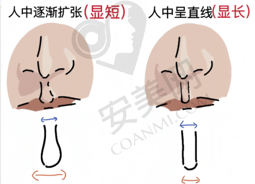 四、如何选择佳木斯韩艺来医疗美容医院的整形项目