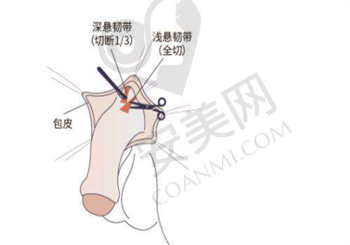 葛敏医生：专精技术保护双眼皮手术质量，她的实力如何？