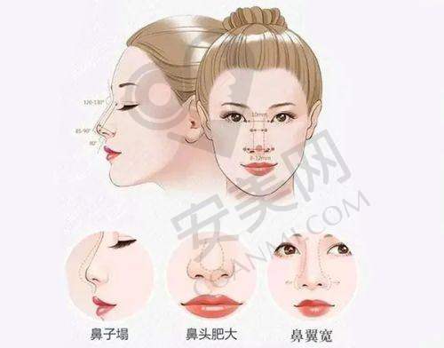 提眉 4800 起能提升眼部整体美感吗？