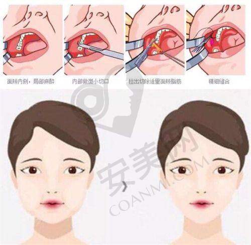 佳木斯韩艺来超声王的成效怎么样？