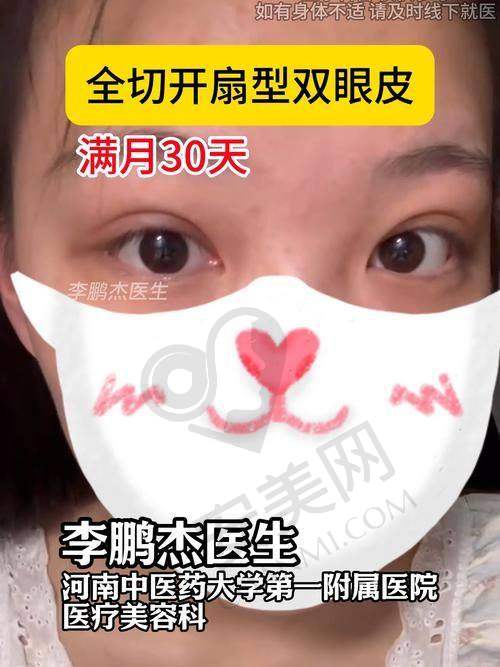 如何选择适合自己的双眼皮整形方案？