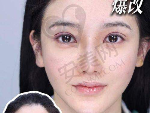 选择上海爱尚丽格杜园园医生的理由