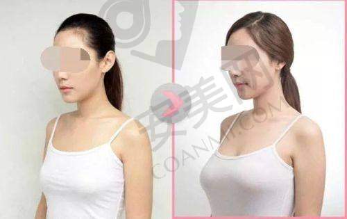 深圳美莱徐占锋医生社会职称