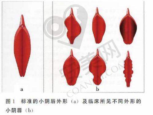 北京嘉禾医院私密整形的价格优势