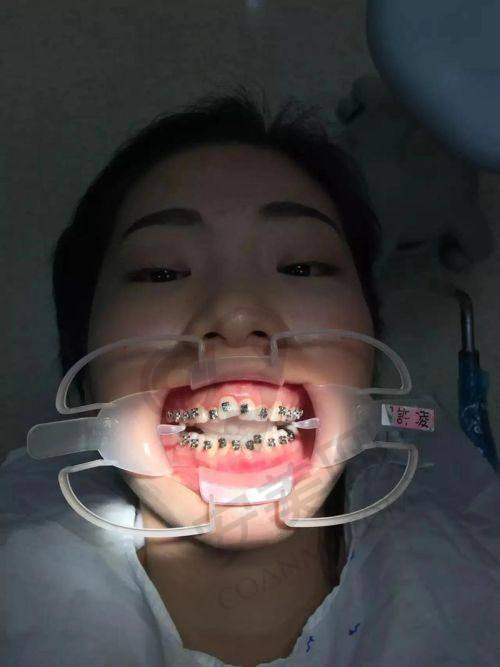 4、廊坊爱嘉口腔杨丹丹医生社会职称：
