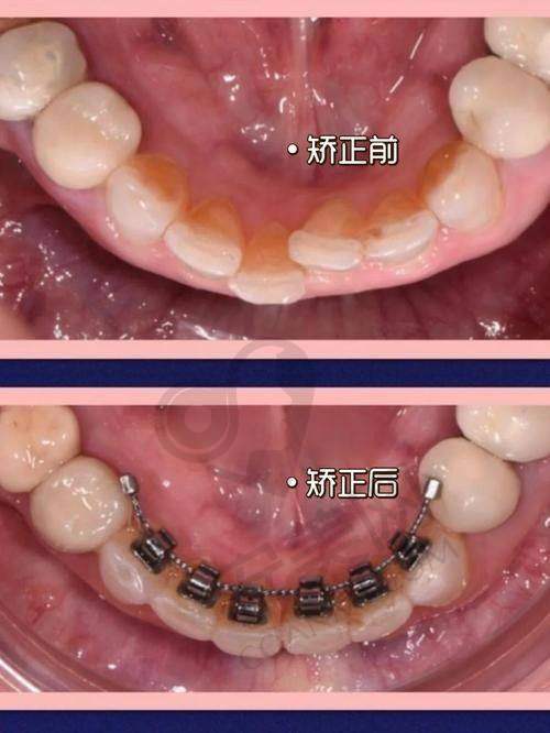 患者评价：口碑到底怎么样？
