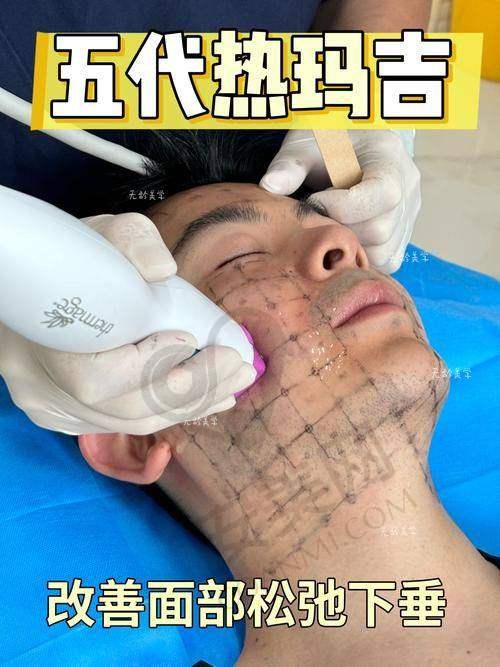 超玛吉就诊当天的具体过程是怎样的？