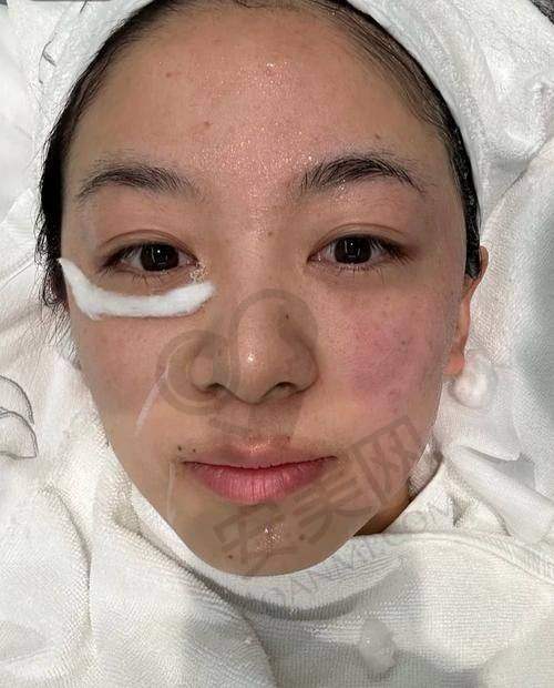 超玛吉就诊前的准备工作有哪些？