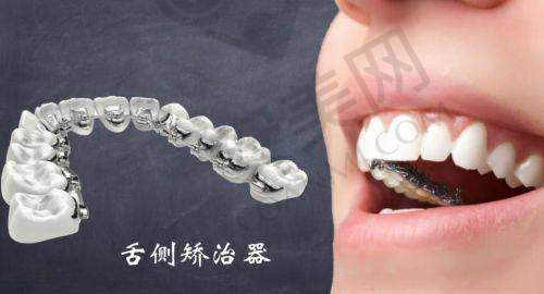 选择长沙美奥口腔：有哪些优势？