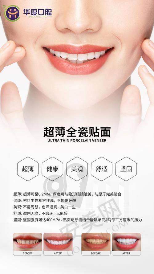 广西蓝天口腔医院牙齿贴面美白4颗5000元起，这个价格贵吗？